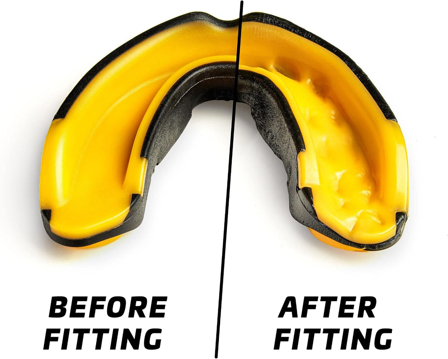 Legenda Mouth Guard Sports w/Case, Professional Mouthguard for Boxing, Football, Hockey, Jiu Jitsu, Muay Thai, MMA, Wrestling and High Contact Sports, Fits Adults, Youth, Kids 11+ (Black/Yellow)